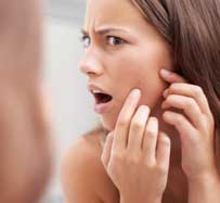 Acne Specialist in Fort Myers, FL