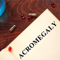 Acromegaly Treatment Clifton | Acromegaly Specialist