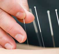 Acupuncture for Weight Loss in Sherman Oaks, CA