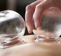 Cupping Therapy Massage in Sherman Oaks, CA