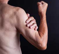 Muscle Loss Treatment | Muscle Atrophy Therapy | Johnson City, TN 