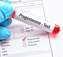 Progesterone Level Testing in Raleigh, NC