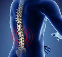 Scoliosis Treatment in Clifton, NJ