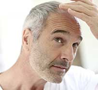 Stem Cell Hair Restoration in Raleigh, NC