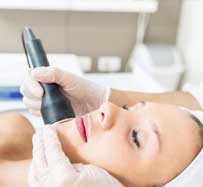 Fractional CO2 laser resurfacing in Raleigh, NC