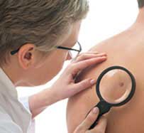 Actinic Keratosis Treatment in Raleigh, NC