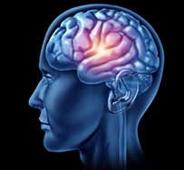 Brain Aneurysm Treatment in Midland Park, NJ