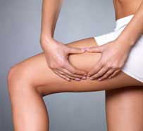 Synergie Cellulite Treatment in Dallas, TX