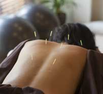 Acupuncture Clinic in Hurst, TX
