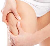 Cellulite Reduction in Roswell, GA