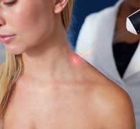 Cryotherapy in Roswell, GA | Whole Body Cryotherapy in Roswell