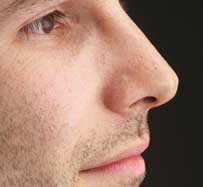 Treatment for Deviated Septum in Midland Park, NJ