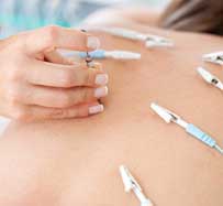 Electroacupuncture in Johnson City, TN