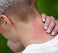 Insect Sting Allergy Treatment in Riverdale, NJ 