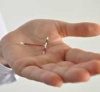Intrauterine Devices (IUDs) | Madison, MS