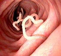Tapeworm Treatment in Annapolis, MD